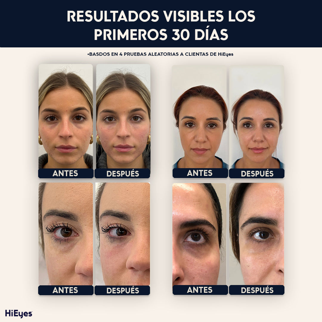 Restora - El fin de la mirada agotada™